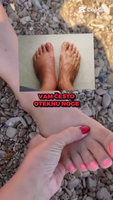 OTIČU VAM STOPALA❓To je čest znak da limfni sistem ne funkcioniše optimalno.👣 Laganim pritiskom na tačke između prstiju i duž limfnih kanala na stopalima,možete pomoći telu da izbaci višak tečnosti i ...